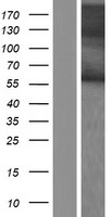 Western blot validation of overexpression lysate (Cat# LY423682) using anti-DDK antibody (Cat# TA50011-100). Left: Cell lysates from un-transfected HEK293T cells; Right: Cell lysates from HEK293T cells transfected with RC218579 using transfection reagent MegaTran 2.0 (Cat# TT210002).