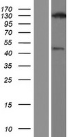 Western blot validation of overexpression lysate (Cat# LY407139) using anti-DDK antibody (Cat# TA50011-100). Left: Cell lysates from un-transfected HEK293T cells; Right: Cell lysates from HEK293T cells transfected with RC218571 using transfection reagent MegaTran 2.0 (Cat# TT210002).