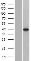 Western blot validation of overexpression lysate (Cat# LY423043) using anti-DDK antibody (Cat# TA50011-100). Left: Cell lysates from un-transfected HEK293T cells; Right: Cell lysates from HEK293T cells transfected with RC218522 using transfection reagent MegaTran 2.0 (Cat# TT210002).