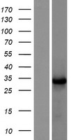 Western blot validation of overexpression lysate (Cat# LY403998) using anti-DDK antibody (Cat# TA50011-100). Left: Cell lysates from un-transfected HEK293T cells; Right: Cell lysates from HEK293T cells transfected with RC218511 using transfection reagent MegaTran 2.0 (Cat# TT210002).