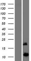 Western blot validation of overexpression lysate (Cat# LY408882) using anti-DDK antibody (Cat# TA50011-100). Left: Cell lysates from un-transfected HEK293T cells; Right: Cell lysates from HEK293T cells transfected with RC219143 using transfection reagent MegaTran 2.0 (Cat# TT210002).