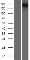 Western blot validation of overexpression lysate (Cat# LY413714) using anti-DDK antibody (Cat# TA50011-100). Left: Cell lysates from un-transfected HEK293T cells; Right: Cell lysates from HEK293T cells transfected with RC219132 using transfection reagent MegaTran 2.0 (Cat# TT210002).