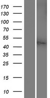 Western blot validation of overexpression lysate (Cat# LY421659) using anti-DDK antibody (Cat# TA50011-100). Left: Cell lysates from un-transfected HEK293T cells; Right: Cell lysates from HEK293T cells transfected with RC219384 using transfection reagent MegaTran 2.0 (Cat# TT210002).
