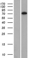 Western blot validation of overexpression lysate (Cat# LY423189) using anti-DDK antibody (Cat# TA50011-100). Left: Cell lysates from un-transfected HEK293T cells; Right: Cell lysates from HEK293T cells transfected with RC219377 using transfection reagent MegaTran 2.0 (Cat# TT210002).
