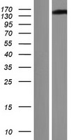 Western blot validation of overexpression lysate (Cat# LY415167) using anti-DDK antibody (Cat# TA50011-100). Left: Cell lysates from un-transfected HEK293T cells; Right: Cell lysates from HEK293T cells transfected with RC219264 using transfection reagent MegaTran 2.0 (Cat# TT210002).
