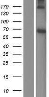 Western blot validation of overexpression lysate (Cat# LY411406) using anti-DDK antibody (Cat# TA50011-100). Left: Cell lysates from un-transfected HEK293T cells; Right: Cell lysates from HEK293T cells transfected with RC219245 using transfection reagent MegaTran 2.0 (Cat# TT210002).