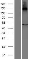 Western blot validation of overexpression lysate (Cat# LY407519) using anti-DDK antibody (Cat# TA50011-100). Left: Cell lysates from un-transfected HEK293T cells; Right: Cell lysates from HEK293T cells transfected with RC218930 using transfection reagent MegaTran 2.0 (Cat# TT210002).