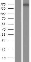 Western blot validation of overexpression lysate (Cat# LY407619) using anti-DDK antibody (Cat# TA50011-100). Left: Cell lysates from un-transfected HEK293T cells; Right: Cell lysates from HEK293T cells transfected with RC218873 using transfection reagent MegaTran 2.0 (Cat# TT210002).