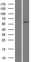 Western blot validation of overexpression lysate (Cat# LY421105) using anti-DDK antibody (Cat# TA50011-100). Left: Cell lysates from un-transfected HEK293T cells; Right: Cell lysates from HEK293T cells transfected with RC218850 using transfection reagent MegaTran 2.0 (Cat# TT210002).
