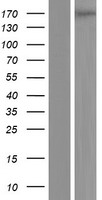Western blot validation of overexpression lysate (Cat# LY406819) using anti-DDK antibody (Cat# TA50011-100). Left: Cell lysates from un-transfected HEK293T cells; Right: Cell lysates from HEK293T cells transfected with RC218833 using transfection reagent MegaTran 2.0 (Cat# TT210002).