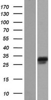 Western blot validation of overexpression lysate (Cat# LY403905) using anti-DDK antibody (Cat# TA50011-100). Left: Cell lysates from un-transfected HEK293T cells; Right: Cell lysates from HEK293T cells transfected with RC212733 using transfection reagent MegaTran 2.0 (Cat# TT210002).