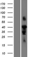 Western blot validation of overexpression lysate (Cat# LY422128) using anti-DDK antibody (Cat# TA50011-100). Left: Cell lysates from un-transfected HEK293T cells; Right: Cell lysates from HEK293T cells transfected with RC212713 using transfection reagent MegaTran 2.0 (Cat# TT210002).