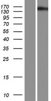 Western blot validation of overexpression lysate (Cat# LY407328) using anti-DDK antibody (Cat# TA50011-100). Left: Cell lysates from un-transfected HEK293T cells; Right: Cell lysates from HEK293T cells transfected with RC212928 using transfection reagent MegaTran 2.0 (Cat# TT210002).