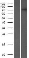 Western blot validation of overexpression lysate (Cat# LY404774) using anti-DDK antibody (Cat# TA50011-100). Left: Cell lysates from un-transfected HEK293T cells; Right: Cell lysates from HEK293T cells transfected with RC212876 using transfection reagent MegaTran 2.0 (Cat# TT210002).