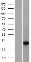 Western blot validation of overexpression lysate (Cat# LY415935) using anti-DDK antibody (Cat# TA50011-100). Left: Cell lysates from un-transfected HEK293T cells; Right: Cell lysates from HEK293T cells transfected with RC212415 using transfection reagent MegaTran 2.0 (Cat# TT210002).