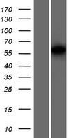 Western blot validation of overexpression lysate (Cat# LY420293) using anti-DDK antibody (Cat# TA50011-100). Left: Cell lysates from un-transfected HEK293T cells; Right: Cell lysates from HEK293T cells transfected with RC212398 using transfection reagent MegaTran 2.0 (Cat# TT210002).