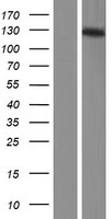 Western blot validation of overexpression lysate (Cat# LY414816) using anti-DDK antibody (Cat# TA50011-100). Left: Cell lysates from un-transfected HEK293T cells; Right: Cell lysates from HEK293T cells transfected with RC212640 using transfection reagent MegaTran 2.0 (Cat# TT210002).