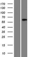 Western blot validation of overexpression lysate (Cat# LY420718) using anti-DDK antibody (Cat# TA50011-100). Left: Cell lysates from un-transfected HEK293T cells; Right: Cell lysates from HEK293T cells transfected with RC212530 using transfection reagent MegaTran 2.0 (Cat# TT210002).