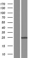 Western blot validation of overexpression lysate (Cat# LY404043) using anti-DDK antibody (Cat# TA50011-100). Left: Cell lysates from un-transfected HEK293T cells; Right: Cell lysates from HEK293T cells transfected with RC212603 using transfection reagent MegaTran 2.0 (Cat# TT210002).
