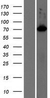 Western blot validation of overexpression lysate (Cat# LY410649) using anti-DDK antibody (Cat# TA50011-100). Left: Cell lysates from un-transfected HEK293T cells; Right: Cell lysates from HEK293T cells transfected with RC212537 using transfection reagent MegaTran 2.0 (Cat# TT210002).