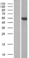 Western blot validation of overexpression lysate (Cat# LY423259) using anti-DDK antibody (Cat# TA50011-100). Left: Cell lysates from un-transfected HEK293T cells; Right: Cell lysates from HEK293T cells transfected with RC212574 using transfection reagent MegaTran 2.0 (Cat# TT210002).