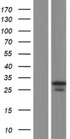 Western blot validation of overexpression lysate (Cat# LY424087) using anti-DDK antibody (Cat# TA50011-100). Left: Cell lysates from un-transfected HEK293T cells; Right: Cell lysates from HEK293T cells transfected with RC212562 using transfection reagent MegaTran 2.0 (Cat# TT210002).