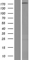 Western blot validation of overexpression lysate (Cat# LY414614) using anti-DDK antibody (Cat# TA50011-100). Left: Cell lysates from un-transfected HEK293T cells; Right: Cell lysates from HEK293T cells transfected with RC212548 using transfection reagent MegaTran 2.0 (Cat# TT210002).