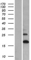Western blot validation of overexpression lysate (Cat# LY405973) using anti-DDK antibody (Cat# TA50011-100). Left: Cell lysates from un-transfected HEK293T cells; Right: Cell lysates from HEK293T cells transfected with RC213404 using transfection reagent MegaTran 2.0 (Cat# TT210002).