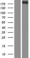 Western blot validation of overexpression lysate (Cat# LY418423) using anti-DDK antibody (Cat# TA50011-100). Left: Cell lysates from un-transfected HEK293T cells; Right: Cell lysates from HEK293T cells transfected with RC213604 using transfection reagent MegaTran 2.0 (Cat# TT210002).
