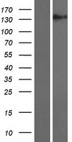 Western blot validation of overexpression lysate (Cat# LY414720) using anti-DDK antibody (Cat# TA50011-100). Left: Cell lysates from un-transfected HEK293T cells; Right: Cell lysates from HEK293T cells transfected with RC213560 using transfection reagent MegaTran 2.0 (Cat# TT210002).