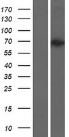 Western blot validation of overexpression lysate (Cat# LY417655) using anti-DDK antibody (Cat# TA50011-100). Left: Cell lysates from un-transfected HEK293T cells; Right: Cell lysates from HEK293T cells transfected with RC213489 using transfection reagent MegaTran 2.0 (Cat# TT210002).