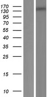 Western blot validation of overexpression lysate (Cat# LY407515) using anti-DDK antibody (Cat# TA50011-100). Left: Cell lysates from un-transfected HEK293T cells; Right: Cell lysates from HEK293T cells transfected with RC213258 using transfection reagent MegaTran 2.0 (Cat# TT210002).