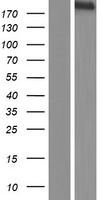 Western blot validation of overexpression lysate (Cat# LY414037) using anti-DDK antibody (Cat# TA50011-100). Left: Cell lysates from un-transfected HEK293T cells; Right: Cell lysates from HEK293T cells transfected with RC213202 using transfection reagent MegaTran 2.0 (Cat# TT210002).