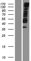 Western blot validation of overexpression lysate (Cat# LY410033) using anti-DDK antibody (Cat# TA50011-100). Left: Cell lysates from un-transfected HEK293T cells; Right: Cell lysates from HEK293T cells transfected with RC213189 using transfection reagent MegaTran 2.0 (Cat# TT210002).