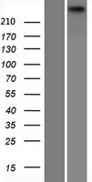 Western blot validation of overexpression lysate (Cat# LY417316) using anti-DDK antibody (Cat# TA50011-100). Left: Cell lysates from un-transfected HEK293T cells; Right: Cell lysates from HEK293T cells transfected with RC211666 using transfection reagent MegaTran 2.0 (Cat# TT210002).
