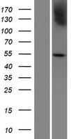 Western blot validation of overexpression lysate (Cat# LY423317) using anti-DDK antibody (Cat# TA50011-100). Left: Cell lysates from un-transfected HEK293T cells; Right: Cell lysates from HEK293T cells transfected with RC211849 using transfection reagent MegaTran 2.0 (Cat# TT210002).