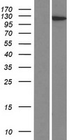 Western blot validation of overexpression lysate (Cat# LY422773) using anti-DDK antibody (Cat# TA50011-100). Left: Cell lysates from un-transfected HEK293T cells; Right: Cell lysates from HEK293T cells transfected with RC211778 using transfection reagent MegaTran 2.0 (Cat# TT210002).