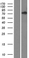 Western blot validation of overexpression lysate (Cat# LY424080) using anti-DDK antibody (Cat# TA50011-100). Left: Cell lysates from un-transfected HEK293T cells; Right: Cell lysates from HEK293T cells transfected with RC211548 using transfection reagent MegaTran 2.0 (Cat# TT210002).