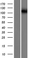 Western blot validation of overexpression lysate (Cat# LY407138) using anti-DDK antibody (Cat# TA50011-100). Left: Cell lysates from un-transfected HEK293T cells; Right: Cell lysates from HEK293T cells transfected with RC211178 using transfection reagent MegaTran 2.0 (Cat# TT210002).