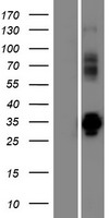 Western blot validation of overexpression lysate (Cat# LY421464) using anti-DDK antibody (Cat# TA50011-100). Left: Cell lysates from un-transfected HEK293T cells; Right: Cell lysates from HEK293T cells transfected with RC211427 using transfection reagent MegaTran 2.0 (Cat# TT210002).