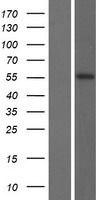 Western blot validation of overexpression lysate (Cat# LY409792) using anti-DDK antibody (Cat# TA50011-100). Left: Cell lysates from un-transfected HEK293T cells; Right: Cell lysates from HEK293T cells transfected with RC212202 using transfection reagent MegaTran 2.0 (Cat# TT210002).