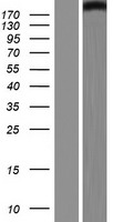 Western blot validation of overexpression lysate (Cat# LY414630) using anti-DDK antibody (Cat# TA50011-100). Left: Cell lysates from un-transfected HEK293T cells; Right: Cell lysates from HEK293T cells transfected with RC212375 using transfection reagent MegaTran 2.0 (Cat# TT210002).