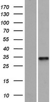 Western blot validation of overexpression lysate (Cat# LY413081) using anti-DDK antibody (Cat# TA50011-100). Left: Cell lysates from un-transfected HEK293T cells; Right: Cell lysates from HEK293T cells transfected with RC212344 using transfection reagent MegaTran 2.0 (Cat# TT210002).