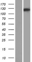 Western blot validation of overexpression lysate (Cat# LY406821) using anti-DDK antibody (Cat# TA50011-100). Left: Cell lysates from un-transfected HEK293T cells; Right: Cell lysates from HEK293T cells transfected with RC212335 using transfection reagent MegaTran 2.0 (Cat# TT210002).