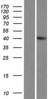 Western blot validation of overexpression lysate (Cat# LY422983) using anti-DDK antibody (Cat# TA50011-100). Left: Cell lysates from un-transfected HEK293T cells; Right: Cell lysates from HEK293T cells transfected with RC212299 using transfection reagent MegaTran 2.0 (Cat# TT210002).