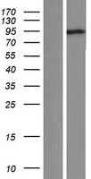 Western blot validation of overexpression lysate (Cat# LY406475) using anti-DDK antibody (Cat# TA50011-100). Left: Cell lysates from un-transfected HEK293T cells; Right: Cell lysates from HEK293T cells transfected with RC212339 using transfection reagent MegaTran 2.0 (Cat# TT210002).