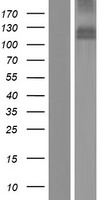 Western blot validation of overexpression lysate (Cat# LY407011) using anti-DDK antibody (Cat# TA50011-100). Left: Cell lysates from un-transfected HEK293T cells; Right: Cell lysates from HEK293T cells transfected with RC212025 using transfection reagent MegaTran 2.0 (Cat# TT210002).