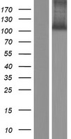 Western blot validation of overexpression lysate (Cat# LY421612) using anti-DDK antibody (Cat# TA50011-100). Left: Cell lysates from un-transfected HEK293T cells; Right: Cell lysates from HEK293T cells transfected with RC211918 using transfection reagent MegaTran 2.0 (Cat# TT210002).