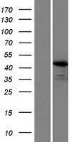 Western blot validation of overexpression lysate (Cat# LY413592) using anti-DDK antibody (Cat# TA50011-100). Left: Cell lysates from un-transfected HEK293T cells; Right: Cell lysates from HEK293T cells transfected with RC215260 using transfection reagent MegaTran 2.0 (Cat# TT210002).