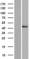 Western blot validation of overexpression lysate (Cat# LY421719) using anti-DDK antibody (Cat# TA50011-100). Left: Cell lysates from un-transfected HEK293T cells; Right: Cell lysates from HEK293T cells transfected with RC215321 using transfection reagent MegaTran 2.0 (Cat# TT210002).